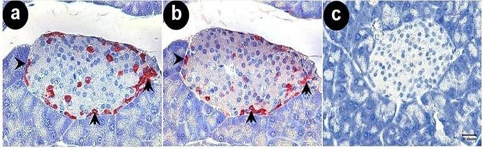 Neuronostatin staining